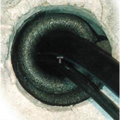 Element centrujący KZ 30 30mm /1000 143491